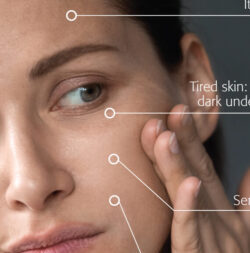 uneven skin care